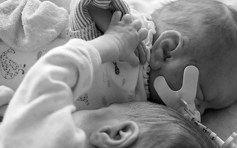 Close up black and white shot of tiny twins cuddling with one having a breathing tube