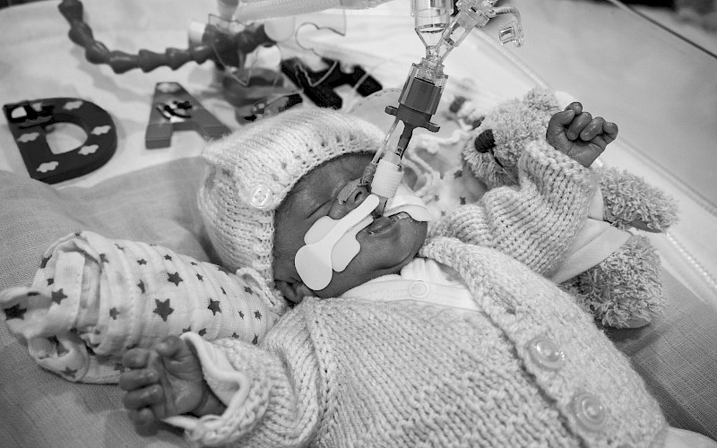 Tiny baby with a breathing tube attached laying in a hospital cot wearing a cardigan and hat